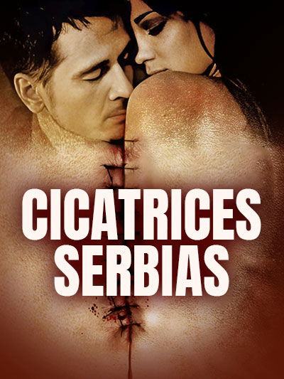 Cicatrices serbias